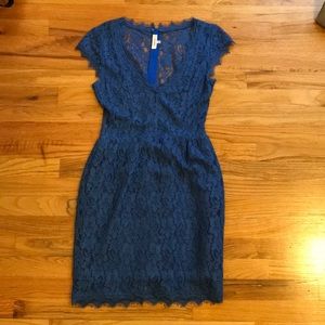 Aritzia lace dress